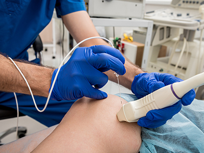 Radiofrequency Ablation Image